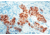 Diagnostic Biosystems Estrogen Receptor CONC. Pab RP 141