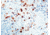 Diagnostic Biosystems Hsv Type Ii Rtu Mab PDM 081