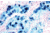 Diagnostic Biosystems Iron Stain Kit 100RXN KT 021