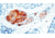 Diagnostic Biosystems Neuron Specific Enolase Mab MOB 212