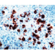 Diagnostic Biosystems Acth CONC. Polyclonal Ab RP 045