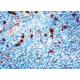 Diagnostic Biosystems ALPHA-1-ANTICHYMOTRYPSIN Rtu PDR 023