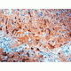 Diagnostic Biosystems Amyloid A Component Rtu Mab PDM 118