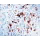 Diagnostic Biosystems Calretinin - Rabbit .5ML RP 043-05