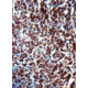 Diagnostic Biosystems CD3 Rtu Mab PDM 126