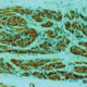 Diagnostic Biosystems CD34 Endothelial Cell Mab MOB 098