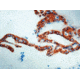 Diagnostic Biosystems Cytokeratin 8 CONC. Mab MOB 054