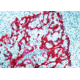 Diagnostic Biosystems Cytokeratin H.M.W. DE-SQ .5ML MOB 275-05