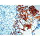 Diagnostic Biosystems Cytokeratin Pan CONC. Mab MOB 108