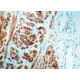 Diagnostic Biosystems Desmin CONC. Polyclonal Ab RP 011