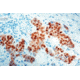 Diagnostic Biosystems Estrogen Receptor CONC. Pab RP 141