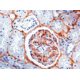 Diagnostic Biosystems Fibronectin CONC. Mab MOB 300