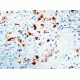 Diagnostic Biosystems Hsv Type Ii Rtu Mab PDM 081