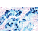 Diagnostic Biosystems Iron Stain Kit 100RXN KT 021