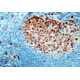 Diagnostic Biosystems KI-67 Antigen CONC. Mab MOB 237