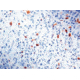 Diagnostic Biosystems Lambda Light Chain CONC. Mab MOB 201