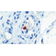 Diagnostic Biosystems MYOD1 - Clone 5.2F .5ML MOB 278-05