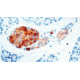 Diagnostic Biosystems Neuron Specific Enolase Mab MOB 212