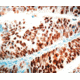 Diagnostic Biosystems P53 Rtu Mab PDM 035