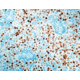 Diagnostic Biosystems Progesterone Receptor Rab .5ML RP 146-05