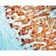 Diagnostic Biosystems Prohibitin CONC. Mab MOB 323