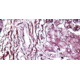 Diagnostic Biosystems Reticulum CHANDLERS Kt 100RXN KT 031
