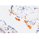 Diagnostic Biosystems Thrombospondin CONC. Mab MOB 315