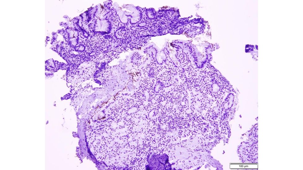 Azer Scientific Control SLIDE, Helicobacter ESCS-130