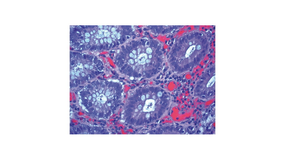 Azer Scientific Formagel 10ml Prefilled Cs128 PFG-20, Unit CS