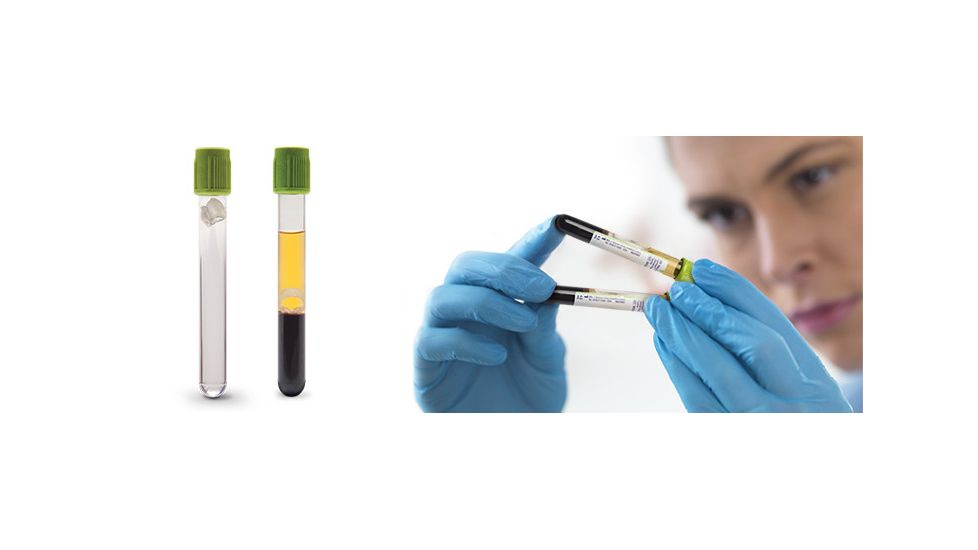 BD Vacutainer Barricor Plasma Blood Collection Tube, Li Heparin, Lime Cap, 13 x 75mm, 365043-PK