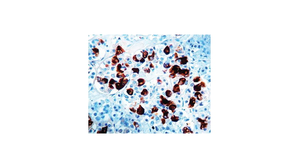 Diagnostic Biosystems Acth CONC. Polyclonal Ab RP 045