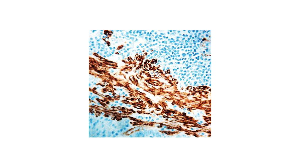 Diagnostic Biosystems Actin Alpha Smooth Muscle Mab MOB 001