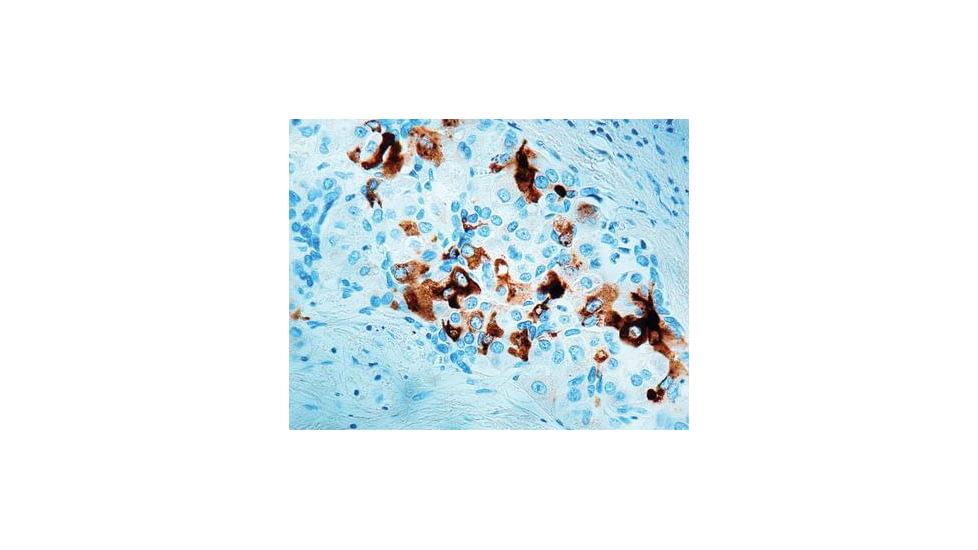 Diagnostic Biosystems Afp - Rabbit .5ML RP 001-05