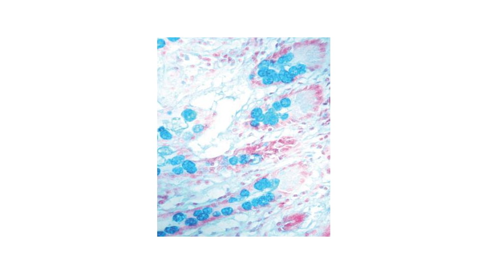 Diagnostic Biosystems Alcian BLUE, Ph 1.0 Kit 100RXN KT 002
