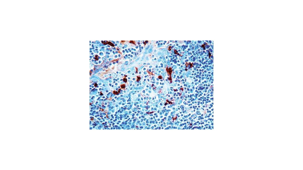 Diagnostic Biosystems ALPHA-1-ANTICHYMOTRYPSIN Rtu PDR 023