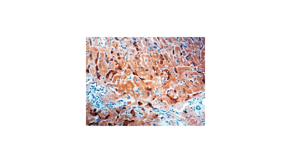 Diagnostic Biosystems Amyloid A Component Rtu Mab PDM 118