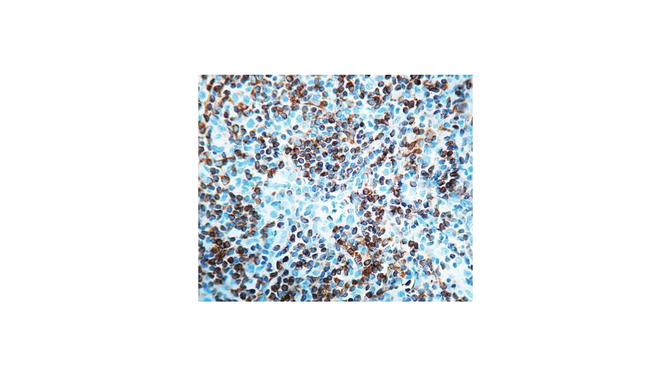 Diagnostic Biosystems BCL-2 Oncoprotein Rtu Mab PDM 016