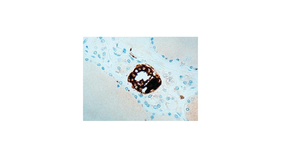Diagnostic Biosystems Calcitonin Rtu Polyclonal Ab PDR 024