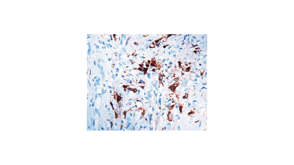Diagnostic Biosystems Calretinin - Rabbit .5ML RP 043-05