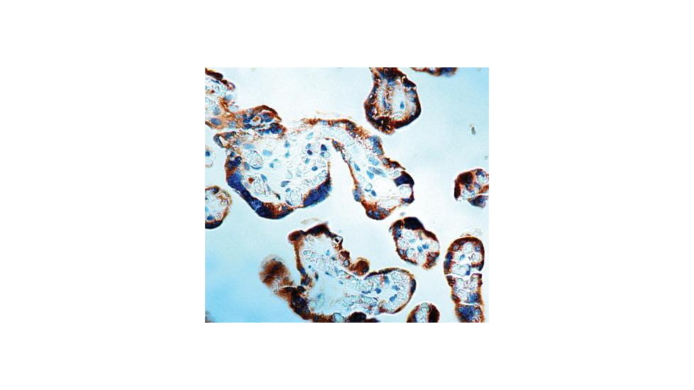 Diagnostic Biosystems Caspase 1 - Rabbit .5ML RP 064-05