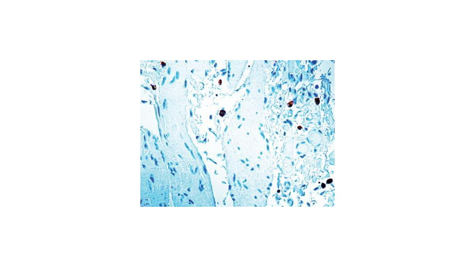 Diagnostic Biosystems Caspase 8 CONC. Polyclonal Ab RP 097