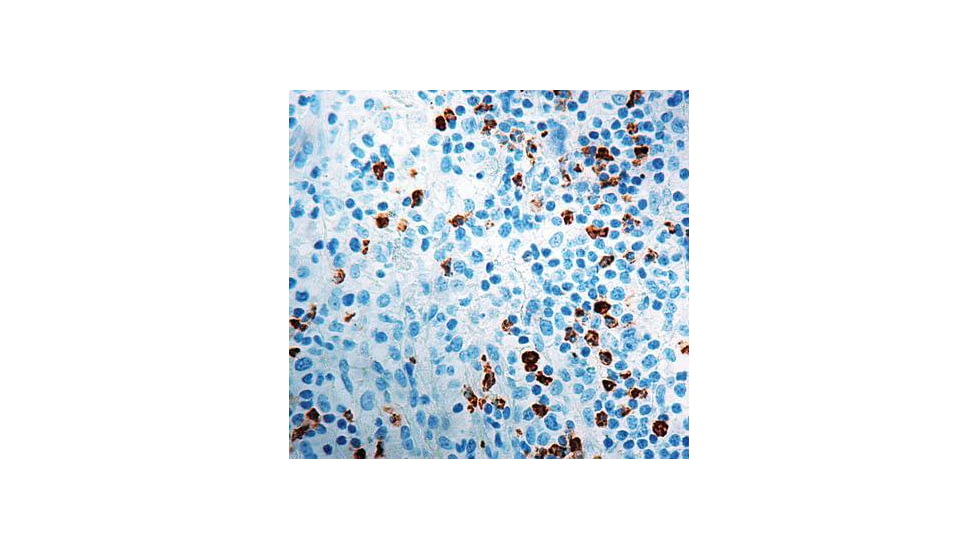 Diagnostic Biosystems CD15 Rtu Mab PDM 127