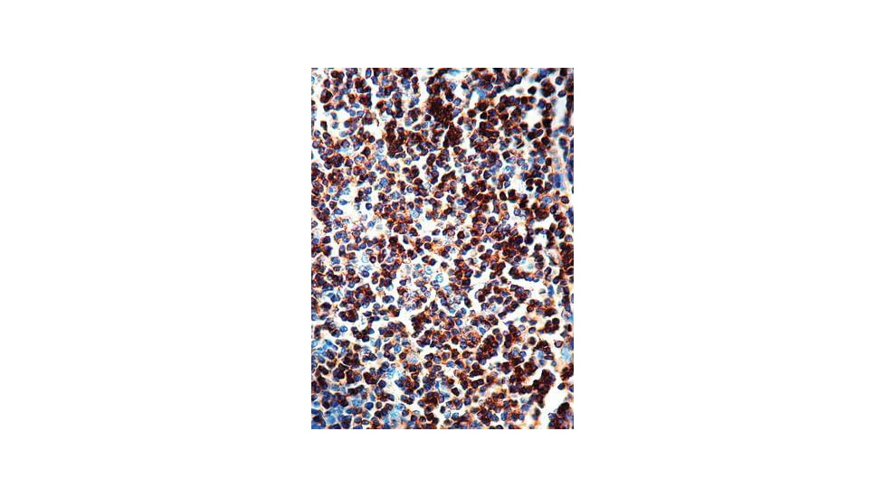 Diagnostic Biosystems CD3 Rtu Mab PDM 126