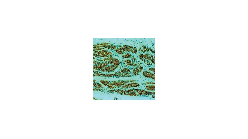 Diagnostic Biosystems CD34 Endothelial Cell Mab MOB 098