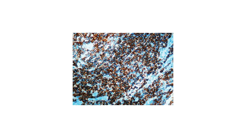 Diagnostic Biosystems CD45 Lca CONC. Mab MOB 040