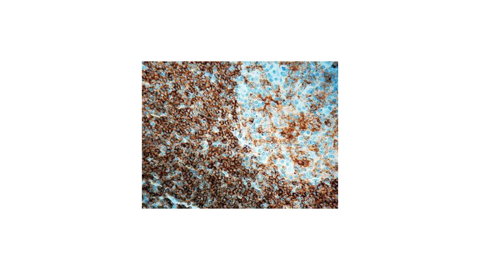 Diagnostic Biosystems CD45RA B Cell Clone 4KB5 .5ML MOB 041-05