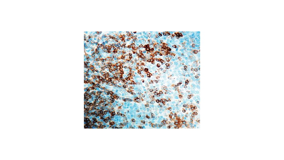 Diagnostic Biosystems CD79A CONC. Polyclonal Ab RP 101