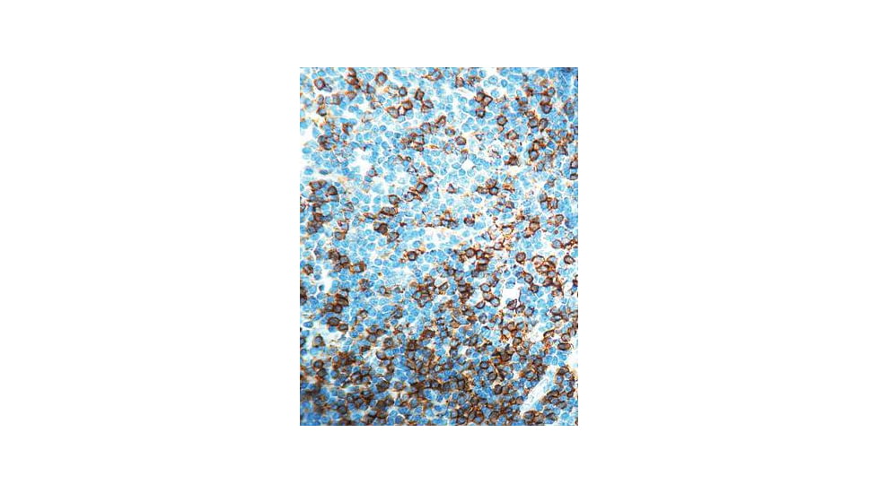 Diagnostic Biosystems CD8 T Cell CONC. Mab MOB117