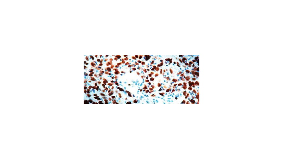 Diagnostic Biosystems CDC47 CONC. Mab MOB 340