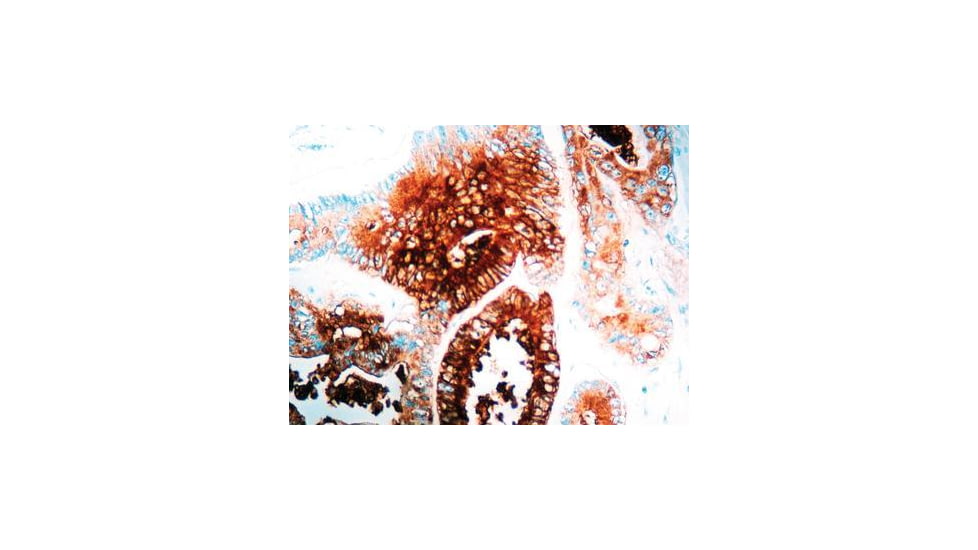Diagnostic Biosystems Cea - Rabbit .5ML RP 003-05